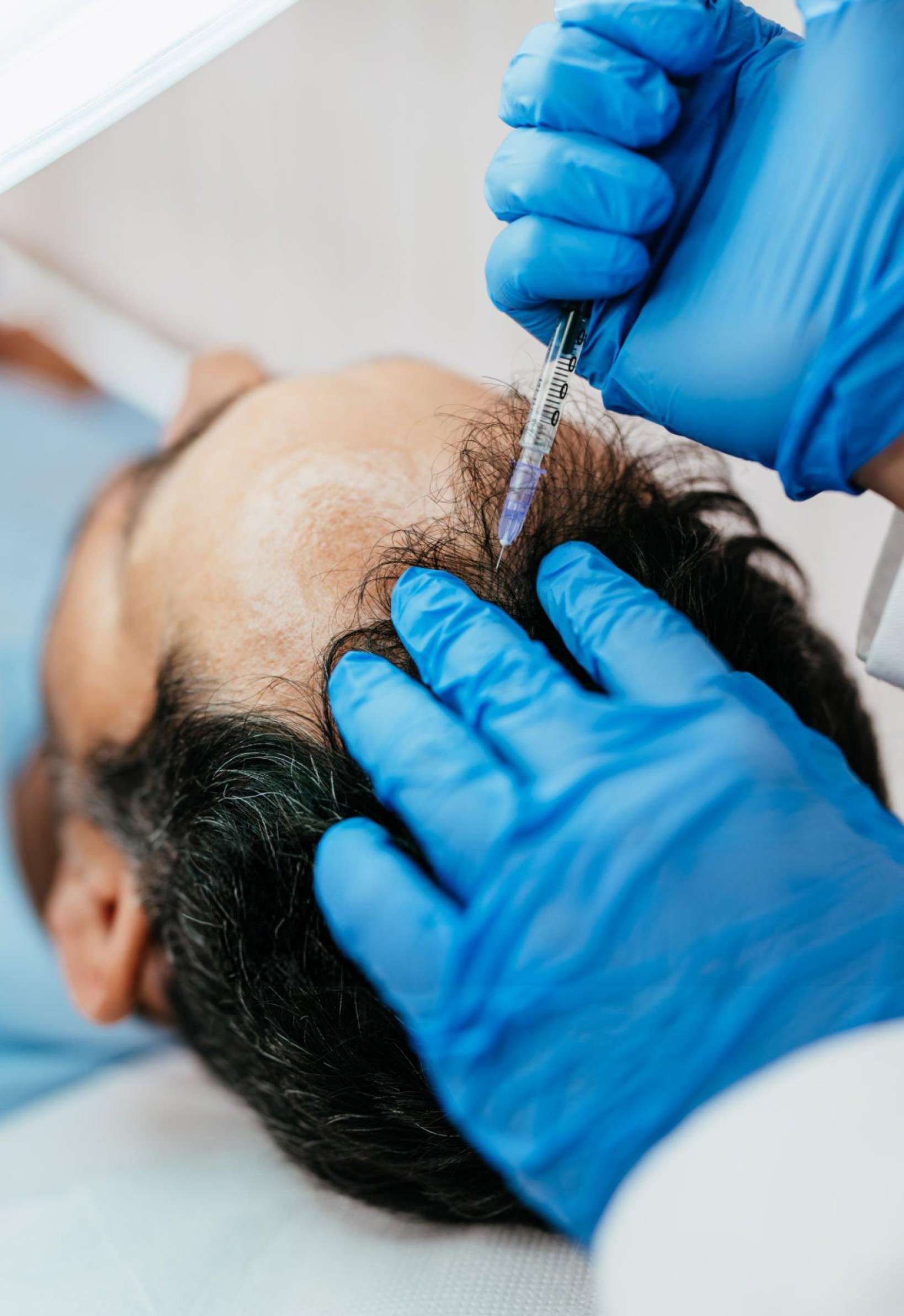 PRP Therapy